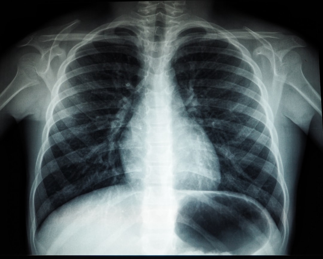 How to Become a Radiologic Technologist